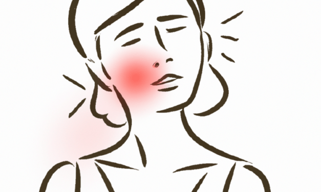 Pityriasis : comment s’en débarrasser de manière naturelle ?